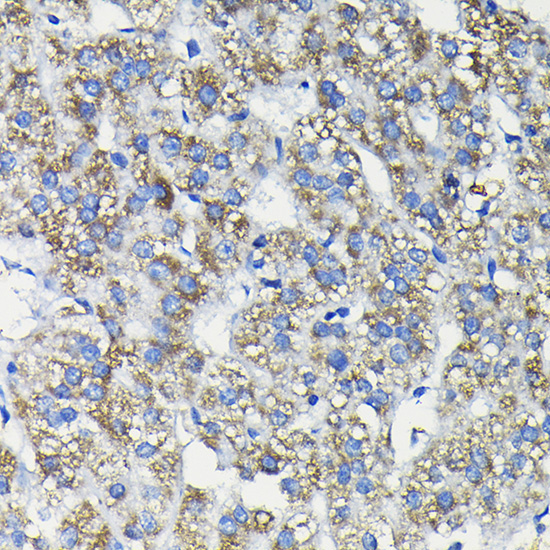 FUCA2 Rabbit Polyclonal Antibody - Image 2