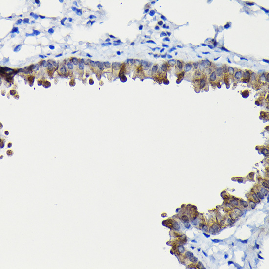 FUCA2 Rabbit Polyclonal Antibody - Image 3