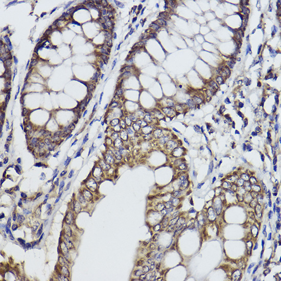 Fukutin Rabbit Monoclonal Antibody - Image 2