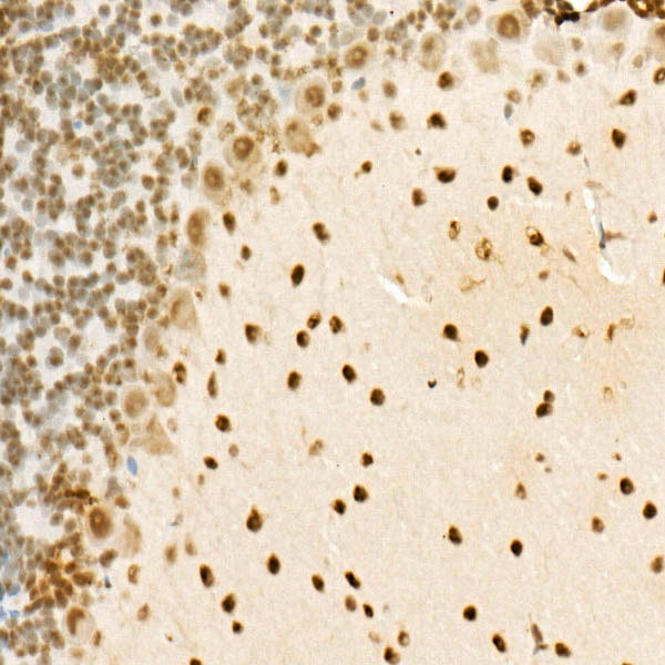 FUS Rabbit Polyclonal Antibody - Image 2