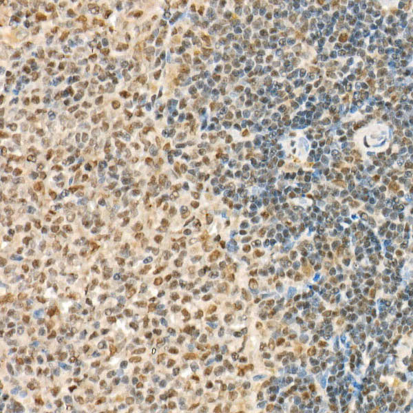FUS Rabbit Polyclonal Antibody - Image 3