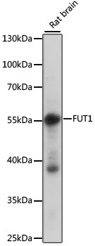 FUT1 Rabbit Polyclonal Antibody