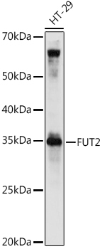 FUT2 Rabbit Polyclonal Antibody