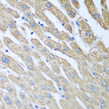 FUT6 Rabbit Polyclonal Antibody - Image 2