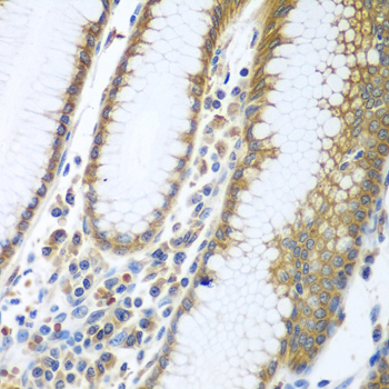 FUT6 Rabbit Polyclonal Antibody - Image 3