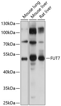 FUT7 Rabbit Polyclonal Antibody