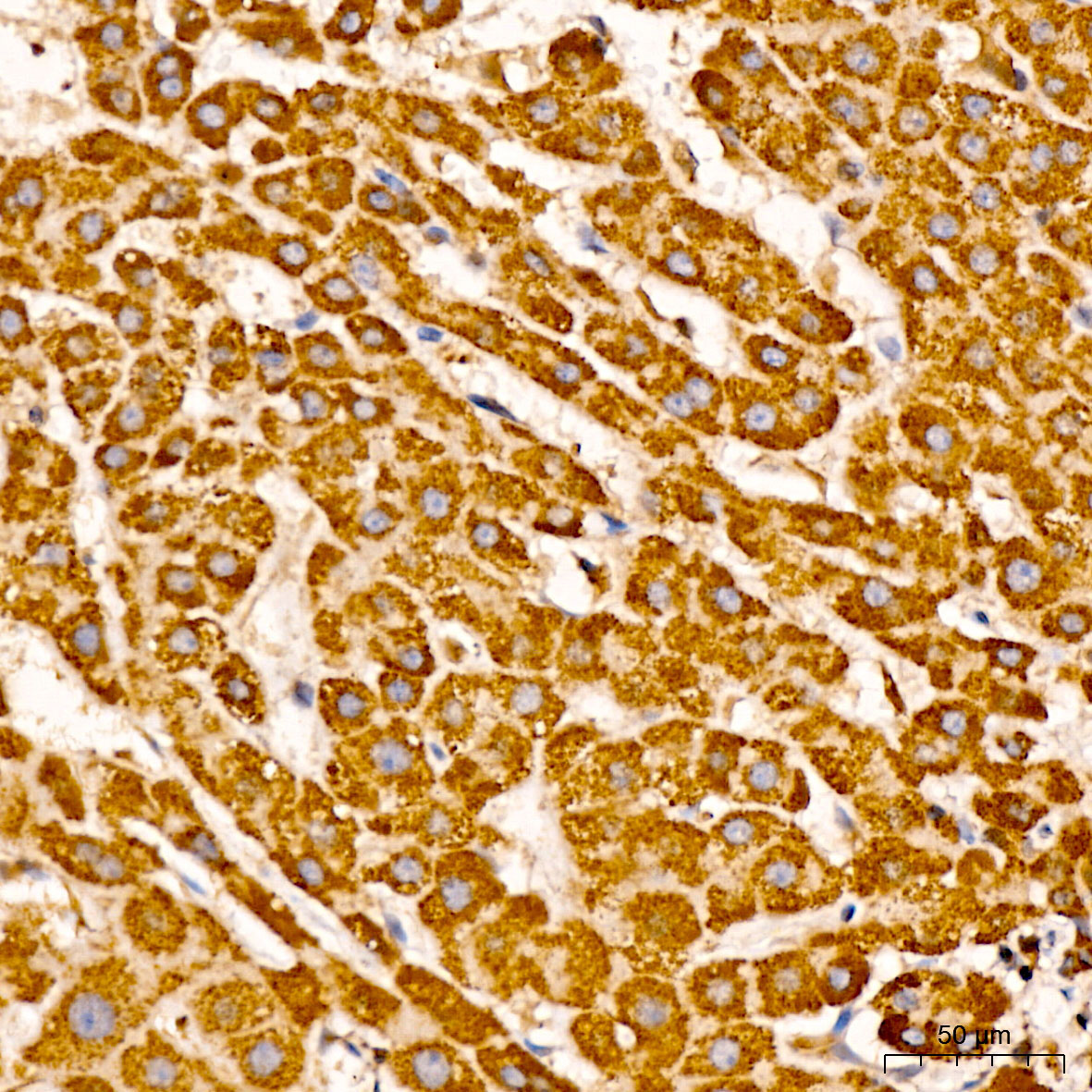 FXN / Frataxin Rabbit Polyclonal Antibody - Image 2