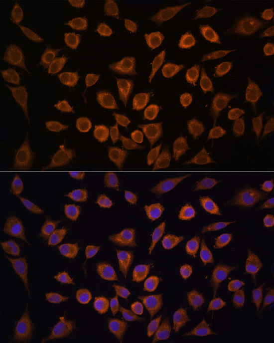FXN / Frataxin Rabbit Polyclonal Antibody - Image 3