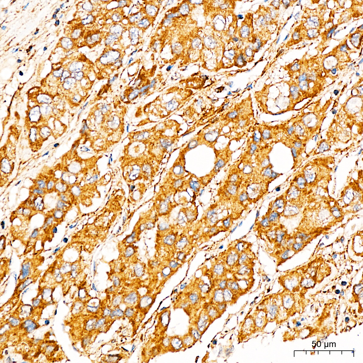 FXN / Frataxin Rabbit Polyclonal Antibody - Image 2