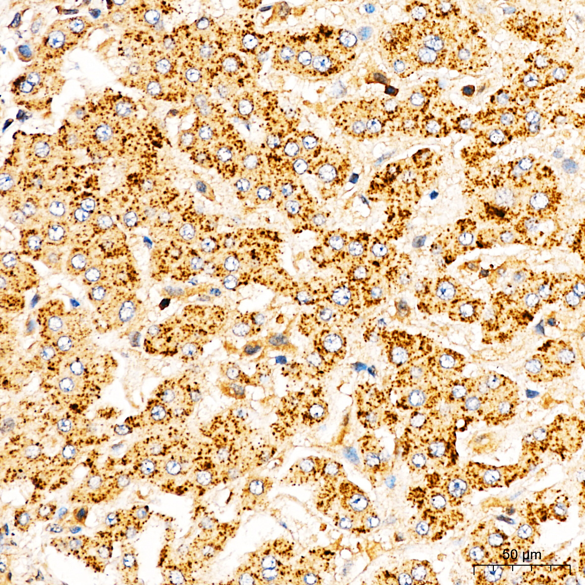 FXN / Frataxin Rabbit Polyclonal Antibody - Image 3