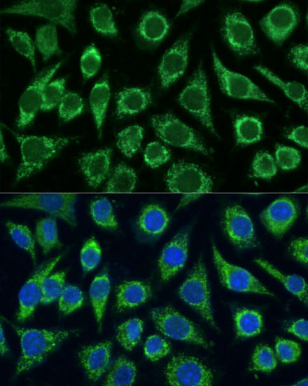 FXN / Frataxin Rabbit Polyclonal Antibody - Image 10