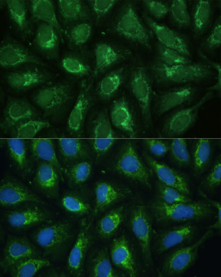 FXN / Frataxin Rabbit Polyclonal Antibody - Image 11