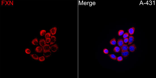 FXN / Frataxin Rabbit Polyclonal Antibody - Image 13