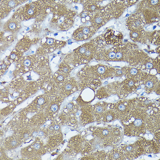 FXN / Frataxin Rabbit Polyclonal Antibody - Image 4