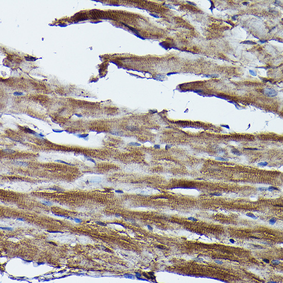 FXN / Frataxin Rabbit Polyclonal Antibody - Image 5