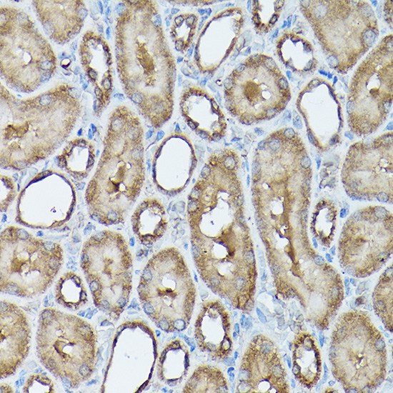 FXN / Frataxin Rabbit Polyclonal Antibody - Image 6