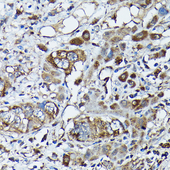 FXN / Frataxin Rabbit Polyclonal Antibody - Image 7