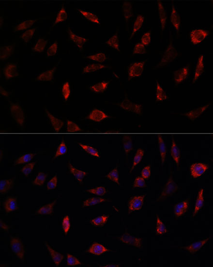 FXN / Frataxin Rabbit Polyclonal Antibody - Image 8