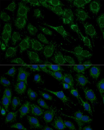 FXN / Frataxin Rabbit Polyclonal Antibody - Image 9