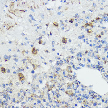 FXN Rabbit Polyclonal Antibody - Image 2