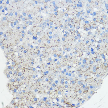 FXN Rabbit Polyclonal Antibody - Image 3
