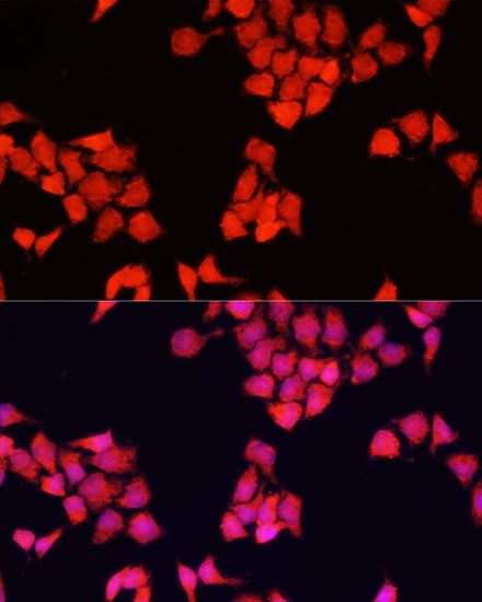 FXR1 Rabbit Polyclonal Antibody