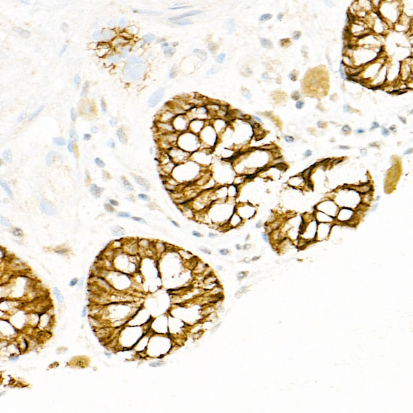 FXYD3 Rabbit Polyclonal Antibody