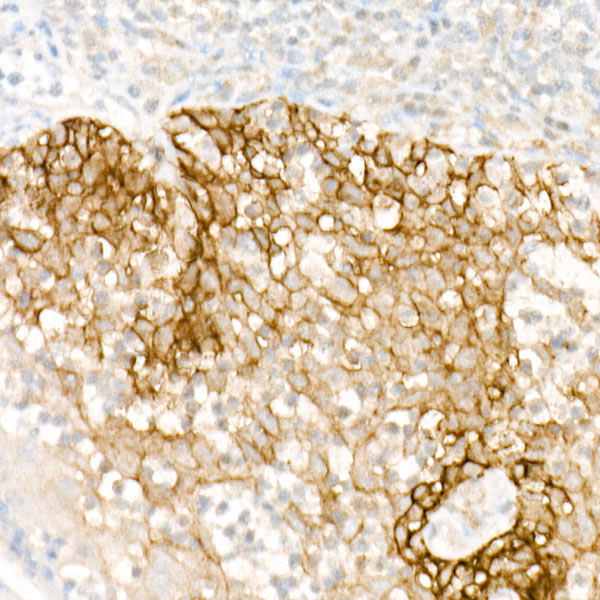 FXYD3 Rabbit Polyclonal Antibody - Image 2