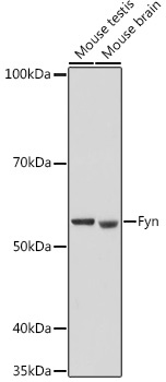 Fyn Rabbit Polyclonal Antibody