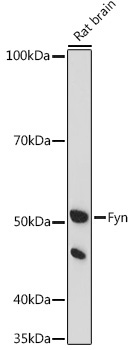 Fyn Rabbit Polyclonal Antibody - Image 2