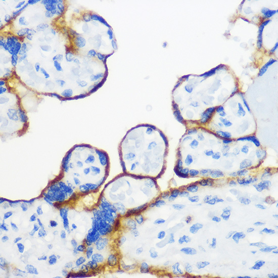 Fyn Rabbit Polyclonal Antibody - Image 3