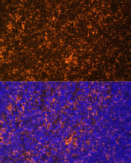Fyn Rabbit Polyclonal Antibody - Image 5
