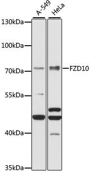 FZD10 Rabbit Polyclonal Antibody