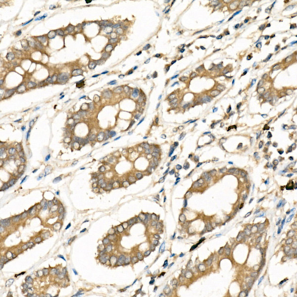 FZD5 Rabbit Polyclonal Antibody - Image 2