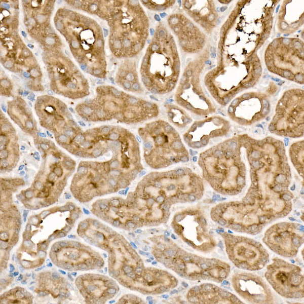 FZD5 Rabbit Polyclonal Antibody - Image 3