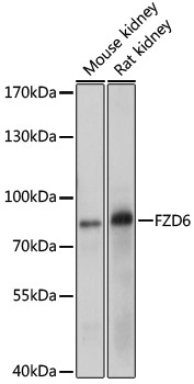 FZD6 Rabbit Polyclonal Antibody