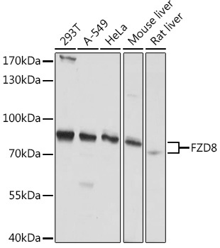 FZD8 Rabbit Polyclonal Antibody