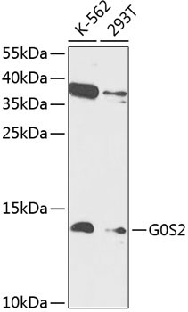 G0S2 Rabbit Polyclonal Antibody