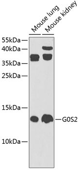 G0S2 Rabbit Polyclonal Antibody