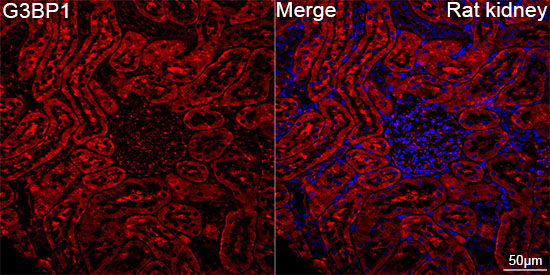 G3BP1 Rabbit Monoclonal Antibody - Image 11