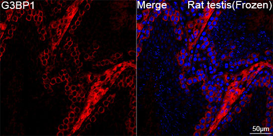 G3BP1 Rabbit Monoclonal Antibody - Image 8