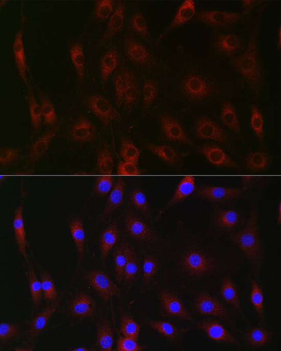 G6PC Rabbit Polyclonal Antibody