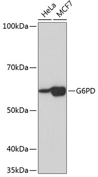 G6PD Rabbit Monoclonal Antibody
