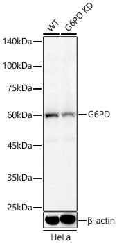 G6PD Rabbit Polyclonal Antibody