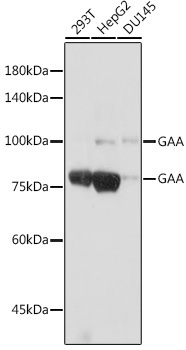 GAA Rabbit Monoclonal Antibody
