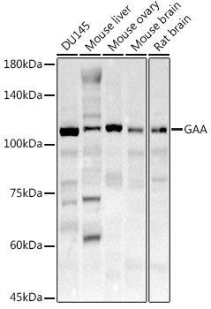 GAA Rabbit Polyclonal Antibody