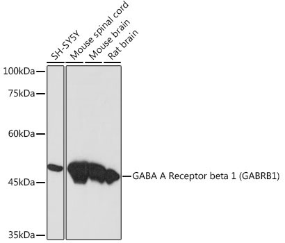 GABA A Receptor beta 1 (GABRB1) Rabbit Monoclonal Antibody