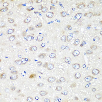 GABARAPL2 Rabbit Polyclonal Antibody - Image 2