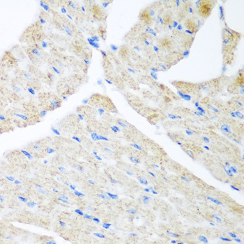 GABARAPL2 Rabbit Polyclonal Antibody - Image 3