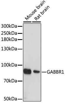 GABBR1 Rabbit Polyclonal Antibody